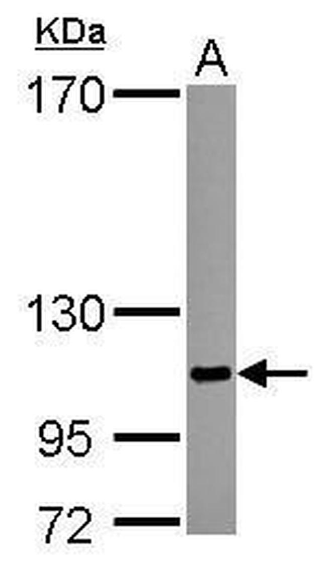 SENP5 Antibody in Western Blot (WB)