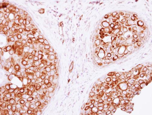 VAM1 Antibody in Immunohistochemistry (Paraffin) (IHC (P))