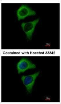 ASB8 Antibody in Immunocytochemistry (ICC/IF)