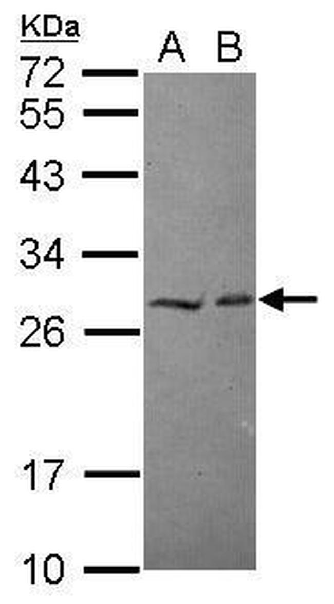 HECTD2 Antibody in Western Blot (WB)