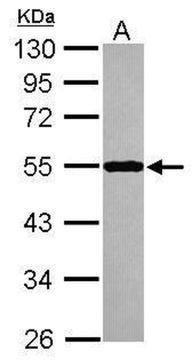 Septin-10 Antibody in Western Blot (WB)