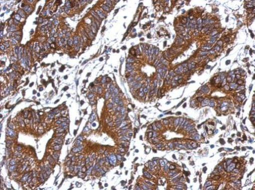 GIMAP4 Antibody in Immunohistochemistry (Paraffin) (IHC (P))