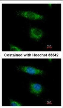 ORP5 Antibody in Immunocytochemistry (ICC/IF)