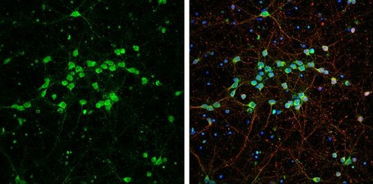 GDF10 Antibody in Immunocytochemistry (ICC/IF)