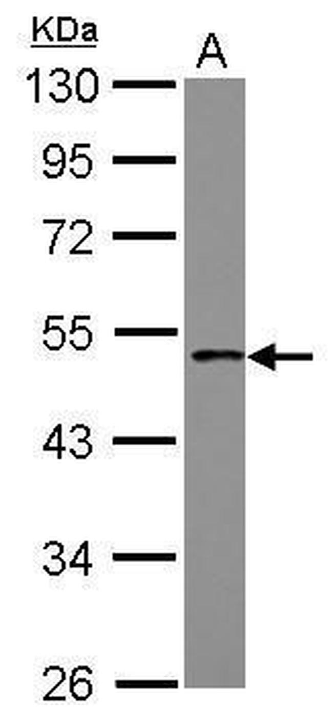 PCYT1B Antibody in Western Blot (WB)