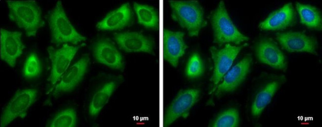 eIF4G3 Antibody in Immunocytochemistry (ICC/IF)