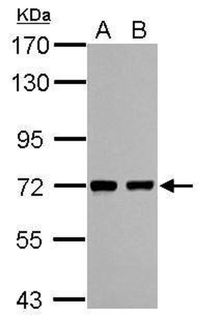 HCC1 Antibody in Western Blot (WB)