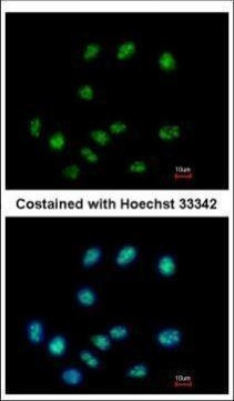 ELAC1 Antibody in Immunocytochemistry (ICC/IF)
