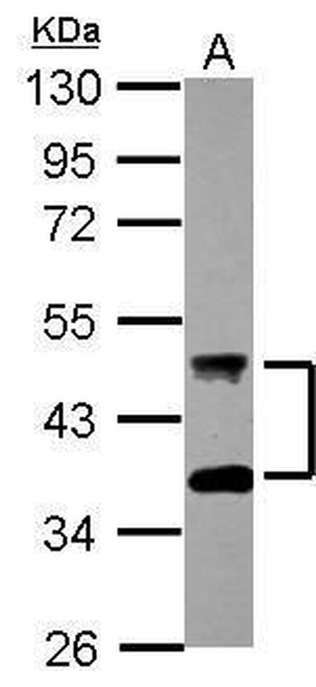 DNAJA4 Antibody in Western Blot (WB)
