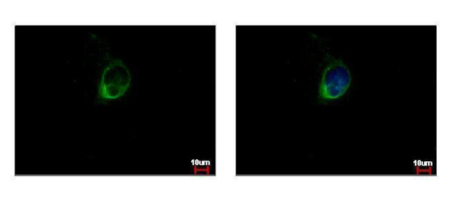 Calpain S1 Antibody in Immunocytochemistry (ICC/IF)
