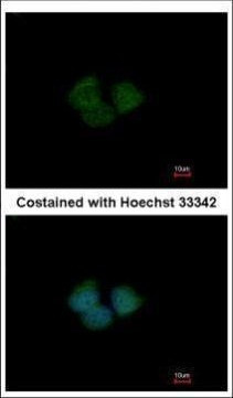 ENC-2 Antibody in Immunocytochemistry (ICC/IF)