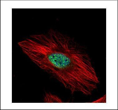 EXOSC8 Antibody in Immunocytochemistry (ICC/IF)
