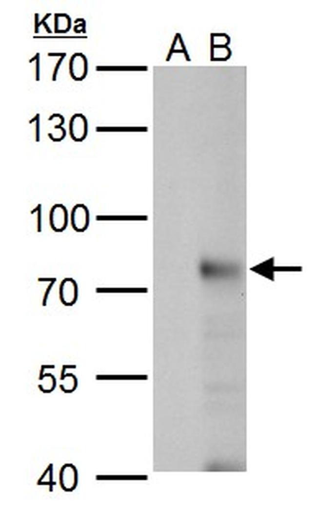 RNF168 Antibody in Western Blot (WB)