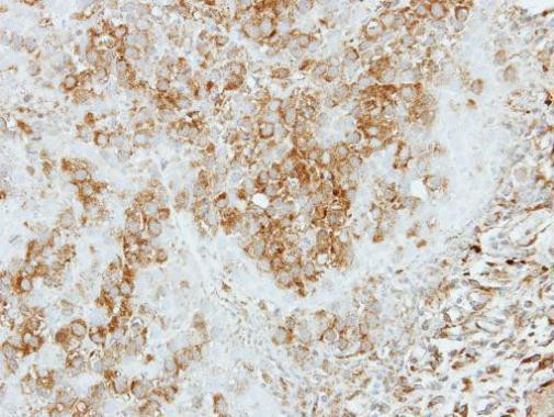 COPS4 Antibody in Immunohistochemistry (Paraffin) (IHC (P))