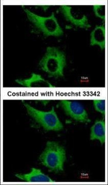 CHMP2B Antibody in Immunocytochemistry (ICC/IF)