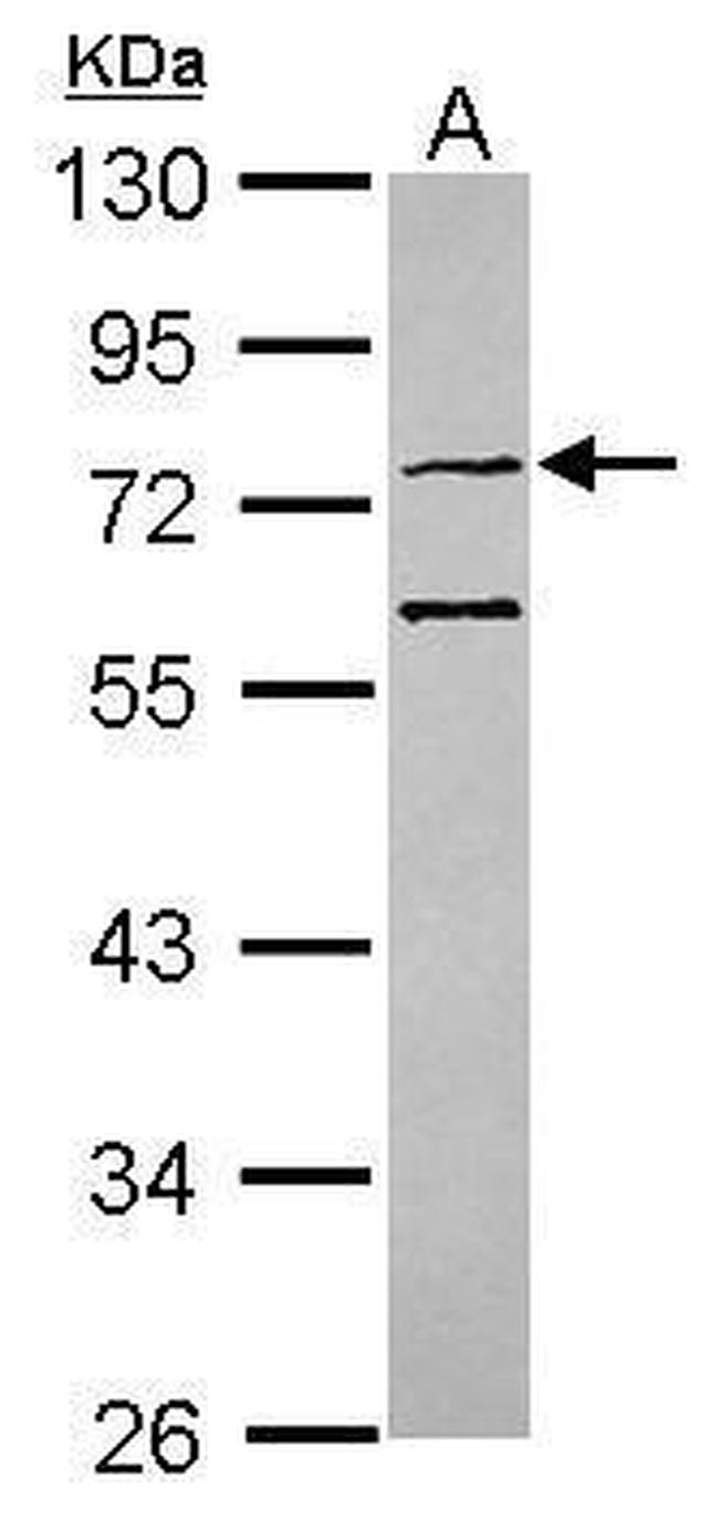 CMG1 Antibody in Western Blot (WB)