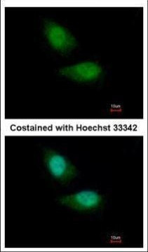 FBXO28 Antibody in Immunocytochemistry (ICC/IF)