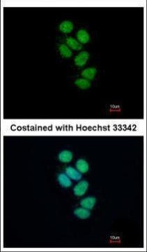 SMNDC1 Antibody in Immunocytochemistry (ICC/IF)