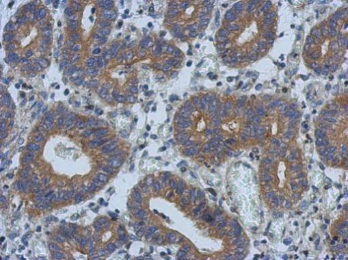 PSD Antibody in Immunohistochemistry (Paraffin) (IHC (P))
