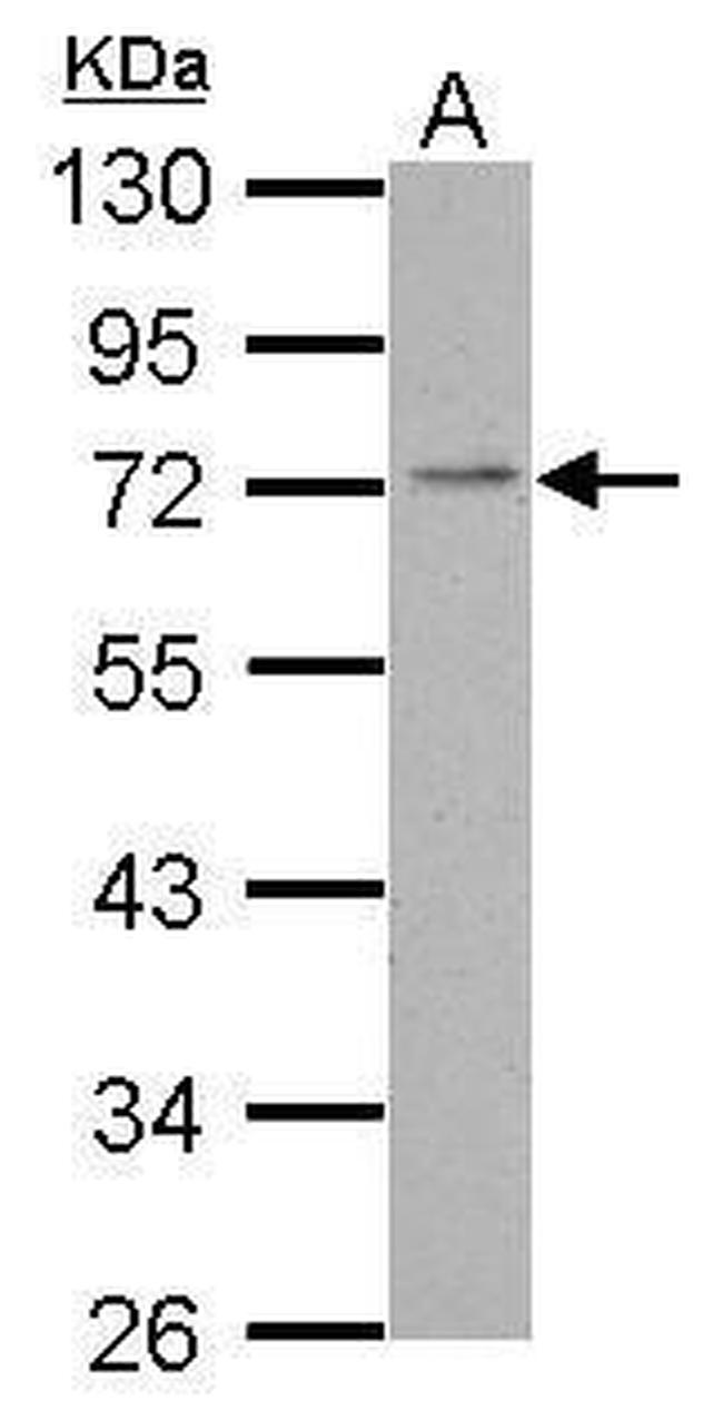 PDE4C Antibody in Western Blot (WB)