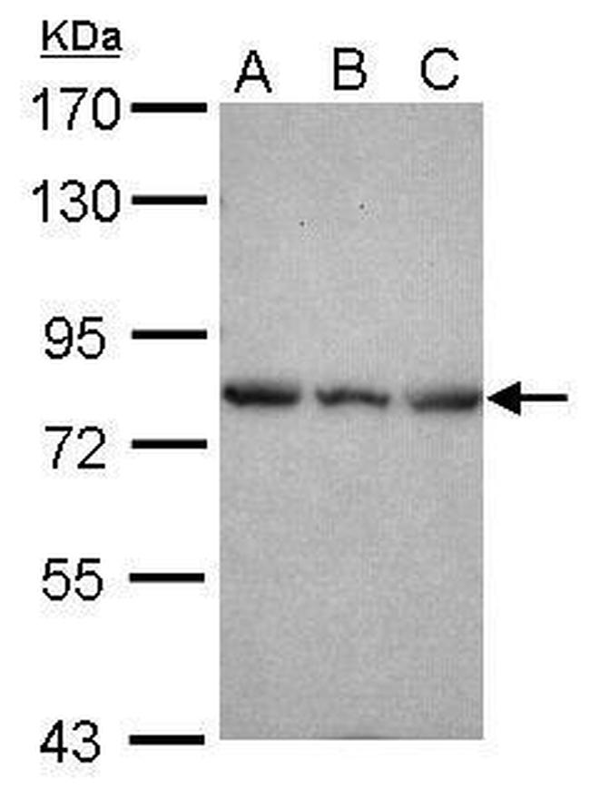 Epsin 2 Antibody in Western Blot (WB)