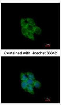 TXNL2 Antibody in Immunocytochemistry (ICC/IF)