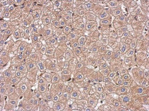 Kindlin 2 Antibody in Immunohistochemistry (Paraffin) (IHC (P))