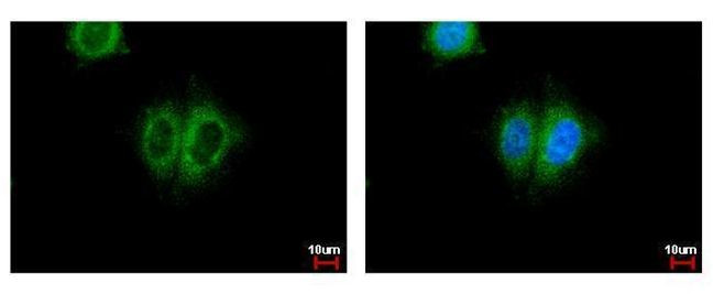 PSME3 Antibody in Immunocytochemistry (ICC/IF)
