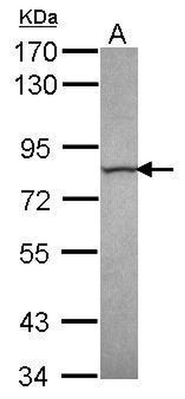 Calpain 13 Antibody in Western Blot (WB)