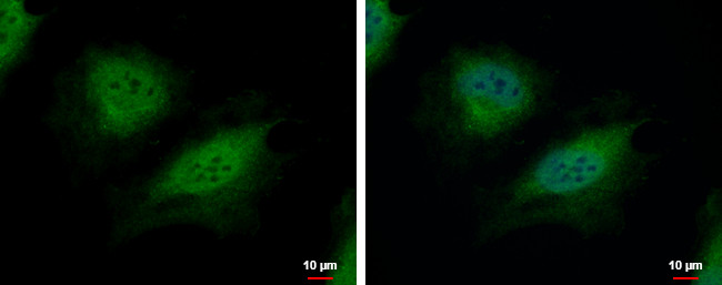 CSRP2BP Antibody in Immunocytochemistry (ICC/IF)