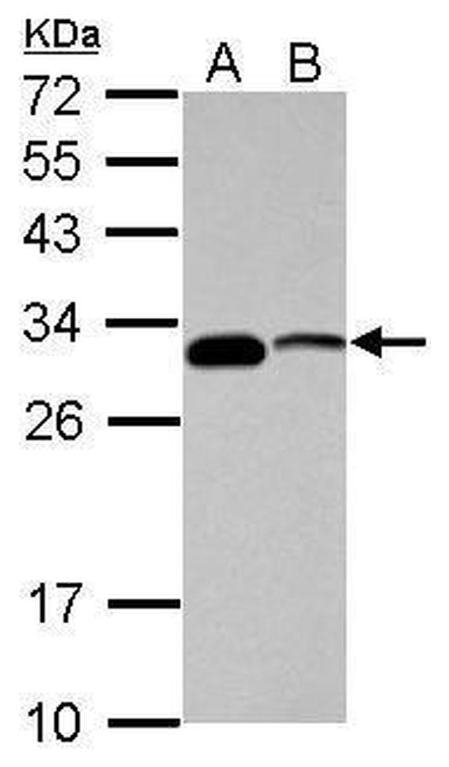 CENPP Antibody in Western Blot (WB)