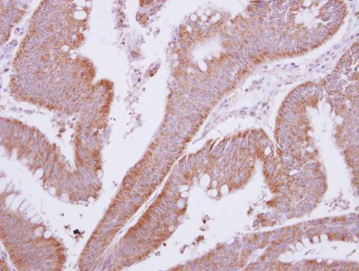 MTMR9 Antibody in Immunohistochemistry (Paraffin) (IHC (P))