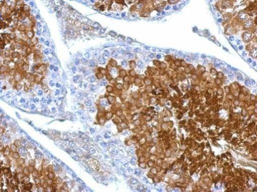 LDHAL6B Antibody in Immunohistochemistry (Paraffin) (IHC (P))