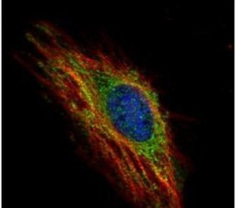 MARCH5 Antibody in Immunocytochemistry (ICC/IF)