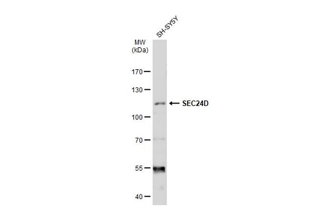 SEC24D Antibody in Western Blot (WB)