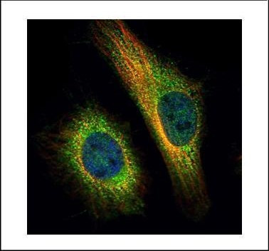 TNPO2 Antibody in Immunocytochemistry (ICC/IF)