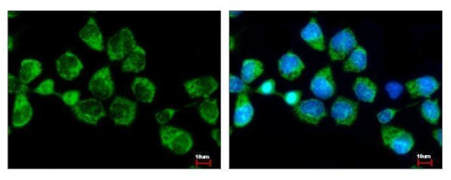 SNX5 Antibody in Immunocytochemistry (ICC/IF)