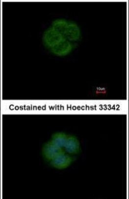 EFHA1 Antibody in Immunocytochemistry (ICC/IF)