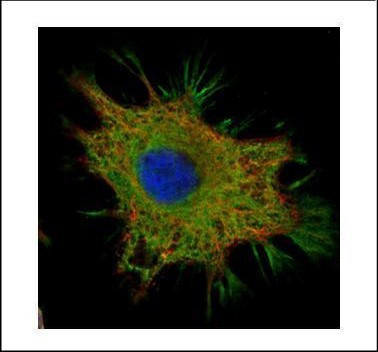 Ymer Antibody in Immunocytochemistry (ICC/IF)