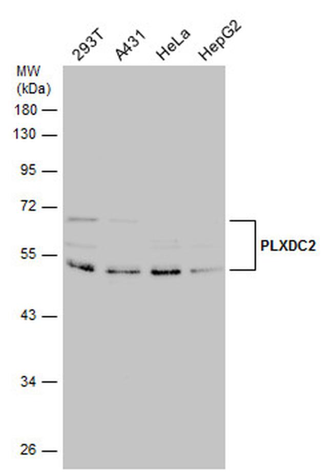 PLXDC2 Antibody in Western Blot (WB)