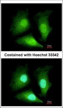 ADI1 Antibody in Immunocytochemistry (ICC/IF)