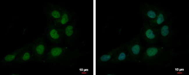 ZNF326 Antibody in Immunocytochemistry (ICC/IF)