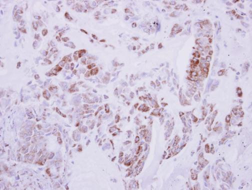 DRG2 Antibody in Immunohistochemistry (Paraffin) (IHC (P))