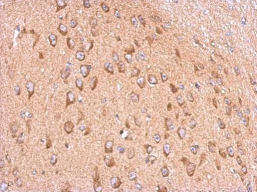 TMEM259 Antibody in Immunohistochemistry (Paraffin) (IHC (P))