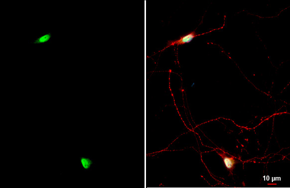 NFIX Antibody in Immunocytochemistry (ICC/IF)
