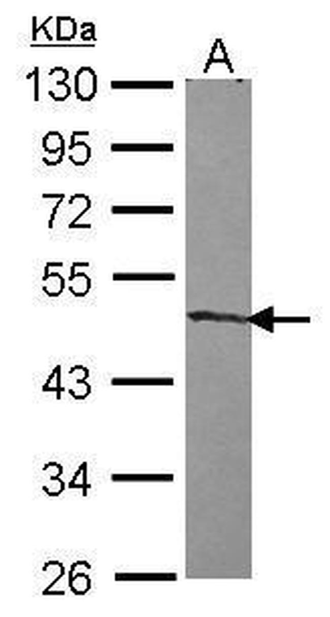 ZNF239 Antibody in Western Blot (WB)