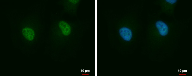 JTV-1 Antibody in Immunocytochemistry (ICC/IF)
