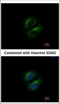 PCBP3 Antibody in Immunocytochemistry (ICC/IF)