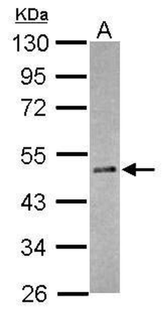 RBM41 Antibody in Western Blot (WB)