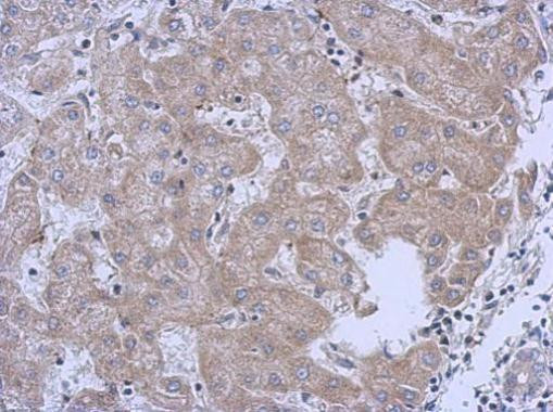 MRPL10 Antibody in Immunohistochemistry (Paraffin) (IHC (P))